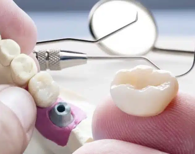 Wisdom tooth removal at Valantine Family Dentistry