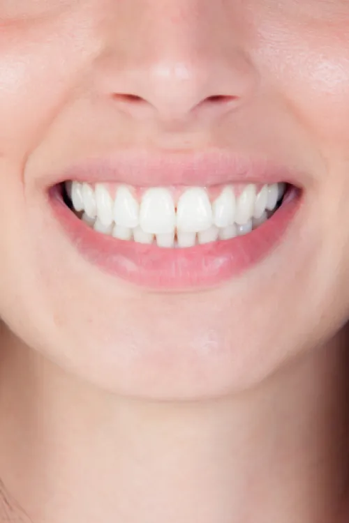 Checkups & cleanings at Valantine Family Dentistry
